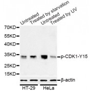 Western blot analysis of extracts of HT-29 and HeLa cells, using Phospho-CDK1-Y15 antibody (abx000105) at 1/1000 dilution. HT-29 cells were treated by serum-starvation overnight. HeLa cells were treated by UV for 15-30 minutes.