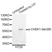 Western blot analysis of extracts of HT-29 cells, using Phospho-CHEK1-Ser280 antibody (abx000106).