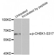 Western blot analysis of extracts of MCF7 cell line, using Phospho-CHEK1-S317 antibody (abx000107).