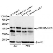 Western blot analysis of extracts of 293 and HeLa cells, using Phospho-CREB1-S133 antibody (abx000108) at 1/1000 dilution. 293 cells were treated by 10% FBS for 30 minutes after serum-starvation overnight. HeLa cells were treated by EGF (100ng/ml) for 30 minutes after serum-starvation overnight.