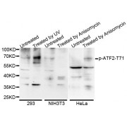 Western blot analysis of extracts of various cells, using Phospho-ATF2-T71 antibody (abx000109).