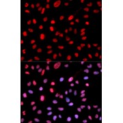 Immunofluorescence analysis of MCF-7 cells using Phospho-Dnmt1-pS714 antibody (abx000110). Blue: DAPI for nuclear staining.