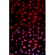 Immunofluorescence analysis of MCF-7 cells using Phospho-Dnmt1-pY399 antibody (abx000111). Blue: DAPI for nuclear staining.