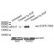 Western blot analysis of extracts of A-431 and HUVEC cells, using Phospho-EGFR-T669 antibody (abx000114) at 1/1000 dilution. A431 cells were treated by EGF (100ng/ml) for 30 minutes after serum-starvation overnight. HUVEC cells were treated by EGF.