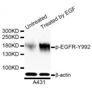 Western blot analysis of extracts of A-431 cells, using Phospho-EGFR-Y992 antibody (abx000115) at 1/1000 dilution. A431 cells were treated by EGF (100ng/ml) for 30 minutes after serum-starvation overnight.