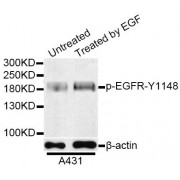 Western blot analysis of extracts of A-431 cells, using Phospho-EGFR-Y1148 antibody (abx000116) at 1/1000 dilution. A431 cells were treated by EGF (100ng/ml) for 30 minutes after serum-starvation overnight.