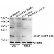 Western blot analysis of extracts of 293T and HeLa cells, using Phospho-EIF4EBP1-S65 antibody (abx000117) at 1/1000 dilution. 293T cells were treated by Insulin (100nM) for 10 minutes after serum-starvation overnight. HeLa cells were treated by 10% FBS after serum-starvation overnight.