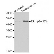 Western blot analysis of extracts from HT29 cells untreated or treated with UV, using Phospho-ELK1-S383 antibody (abx000118).