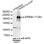 Western blot analysis of extracts of A-431 cells, using Phospho-ERBB4-Y1284 antibody (abx000119) at 1/1000 dilution. A431 cells were treated by EGF (100ng/ml) for 30 minutes after serum-starvation overnight.