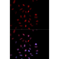 Proto-Oncogene C-Fos (pT232) (FOS) Antibody