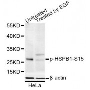 Western blot analysis of extracts of HeLa cells, using Phospho-HSPB1-S15 antibody (abx000125) at 1/1000 dilution. HeLa cells were treated by EGF (100ng/ml) for 30 minutes after serum-starvation overnight.