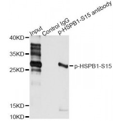 HSPB1 (pS15) Antibody