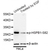 Western blot analysis of extracts of HeLa cells, using Phospho-HSPB1-S82 antibody (abx000126) at 1/1000 dilution. HeLa cells were treated by EGF (100ng/ml) for 30 minutes after serum-starvation overnight.