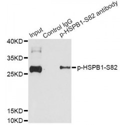 HSPB1 (pS82) Antibody