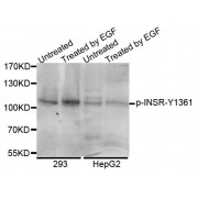 Western blot analysis of extracts of various cell lines, using Phospho-INSR-Y1361 antibody (abx000127).