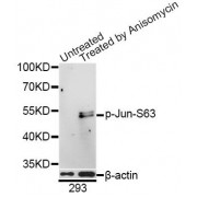 Western blot analysis of extracts of 293 cells, using Phospho-Jun-S63 antibody (abx000133) at 1/1000 dilution. 293 cells were treated by Anisomycin (25 µg/ml) for 30 minutes after serum-starvation overnight.
