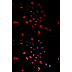 c-Jun (pS63) Antibody