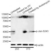 Western blot analysis of extracts of 293 and NIH/3T3 cells, using Phospho-Jun-S243 antibody (abx000135) at 1/1000 dilution. 293 cells were treated by UV for 15-30 minutes. NIH/3T3 cells were treated by Anisomycin (25 µg/ml) for 30 minutes.