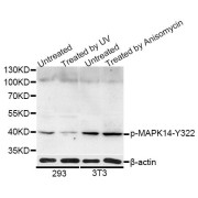 Western blot analysis of extracts of 293 and NIH/3T3 cells, using Phospho-MAPK14-Y322 antibody (abx000137) at 1/1000 dilution. 293 cells were treated by UV for 15-30 minutes. NIH/3T3 cells were treated by Anisomycin (25 µg/ml) for 30 minutes.