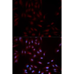 Mitogen-Activated Protein Kinase 14 Phospho-Tyr322 (MAPK14 pY322) Antibody