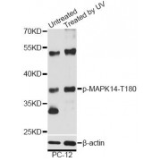 Western blot analysis of extracts of PC-12 cells, using Phospho-MAPK14-T180 antibody (abx000138) at 1/2000 dilution. PC-12 cells were treated by UV for 15-30 minutes.