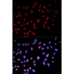 Mitogen-Activated Protein Kinase 14 Phospho-Thr180 (MAPK14 pT180) Antibody