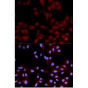 Immunofluorescence analysis of U2OS cells using Phospho-MAPK14-Y182 antibody (abx000139). Blue: DAPI for nuclear staining.