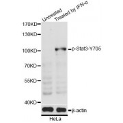 Western blot analysis of extracts of HeLa cells, using Phospho-Stat3-Y705 antibody (abx000144) at 1/2000 dilution. HeLa cells were treated by IFN-α (100ng/ml) for 30 minutes after serum-starvation overnight.