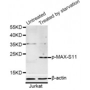 Western blot analysis of extracts of Jurkat cells, using Phospho-MAX-S11 antibody (abx000145) at 1/1000 dilution. Jurkat cells were treated by serum-starvation overnight.