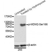 Western blot analysis of extracts of 293 cells, using Phospho-MDM2-S166 antibody (abx000146). 293 cells were treated by Hydroxyurea (4mM) for 20 hours.