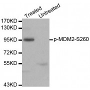 Western blot analysis of extracts of 293 cell line, using phospho-MDM2-S260 antibody (abx000147).