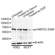 Western blot analysis of extracts of K-562 and MCF-7 cells, using Phospho-MEF2C-S396 antibody (abx000148) at 1/1000 dilution. K562 cells were treated by 10% FBS for 30 minutes after serum-starvation overnight. MCF7 cells were treated by EGF (100ng/ml) for 30 minutes after serum-starvation overnight.