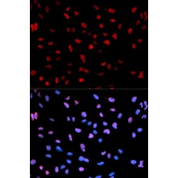 MEF2C (pS396) Antibody