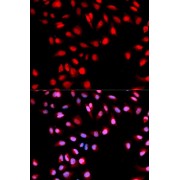 Immunofluorescence analysis of U2OS cells using Phospho-MET-Y1003 antibody (abx000149). Blue: DAPI for nuclear staining.