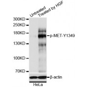 Immunofluorescence analysis of U2OS cells using Phospho-MET-Y1349 antibody (abx000150). Blue: DAPI for nuclear staining.
