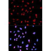 Immunofluorescence analysis of U2OS cells using Phospho-MET-Y1234 antibody (abx000151). Blue: DAPI for nuclear staining.