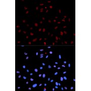 Immunofluorescence analysis of U2OS cells using Phospho-MET-Y1235 antibody (abx000152). Blue: DAPI for nuclear staining.