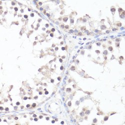 MYC (pT58) Antibody