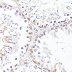 MYC (pT58) Antibody