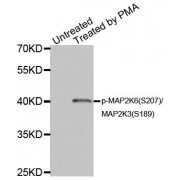 Western blot analysis of extracts of HL60 cell lines, using Phospho-MAP2K6-S207/MAP2K3-S189 antibody (abx000154).