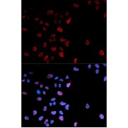 Immunofluorescence analysis of U2OS cells using Phospho-MYC-S62 antibody (abx000155). Blue: DAPI for nuclear staining.