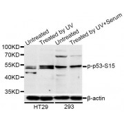 Western blot analysis of extracts of HT-29 and 293 cells, using Phospho-p53-S15 antibody (abx000156) at 1/1000 dilution. HT-29 cells were treated by UV for 15-30 minutes. 293 cells were treated by UV for 15-30 minutes.