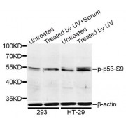 Western blot analysis of extracts of 293 and HT-29 cells, using Phospho-p53-S9 antibody (abx000157) at 1/1000 dilution. 293 cells were treated by UV for 15-30 minutes. HT-29 cells were treated by UV for 15-30 minutes.