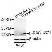 Western blot analysis of extracts of A-431 cells, using Phospho-RAC1-S71 antibody (abx000158) at 1/1000 dilution. A431 cells were treated by EGF (100ng/ml) for 30 minutes after serum-starvation overnight.