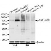 Western blot analysis of extracts of HeLa and 293T cells, using Phospho-RAF1-S621 antibody (abx000159) at 1/1000 dilution. HeLa cells were treated by EGF (100ng/ml) for 30 minutes after serum-starvation overnight. 293T cells were treated by PMA/TPA (200nM) for 30 minutes or treated by EGF (25 µg/ml) for 30 minutes after serum-starvation overnight.