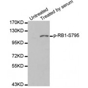 Western blot analysis of extracts of 293 cell line, using phospho-RB-S795 antibody (abx000160).