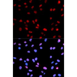 Retinoblastoma Protein 1 Phospho-Ser795 (RB1 pS795) Antibody