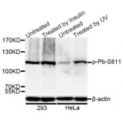 Western blot analysis of extracts of 293 and HeLa cells, using Phospho-Rb-S811 antibody (abx000161) at 1/1000 dilution. 293 cells were treated by Insulin (100nM) for 10 minutes after serum-starvation overnight. HeLa cells were treated by UV for 15-30 minutes.