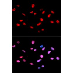 Retinoblastoma Protein 1 Phospho-Ser811 (RB1 pS811) Antibody