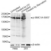 Western blot analysis of extracts of HeLa and 293 cells, using Phospho-SMC1A-S957 antibody (abx000162) at 1/1000 dilution. HeLa cells were treated by UV for 15-30 minutes. 293 cells were treated by serum-starvation overnight.